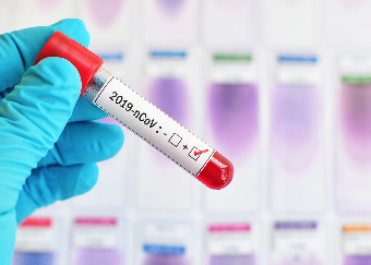 COVID-19: da GIMBE l’evoluzione dell’epidemia nei numeri di Protezione Civile e Ministero della Salute