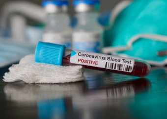 COVID-19, lettera aperta dalle TIWS (Top Italian Women Scientists) e dal Network di ricerca HIV